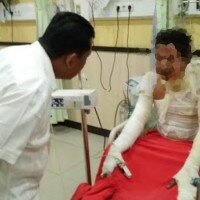 Petugas meminta keterangan pada pria yang bakar diri di Pondok Ranggon, Jakarta Timur. (ifand)