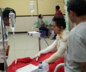 Pria yang bakar diri dirawat di RS Polri Kramatjati.(ifand)